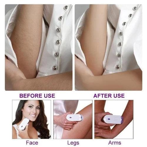 Rechargeable Yes! Finishing Touch Hair Removal Machine - A Smooth & Pain Free Hair Remover